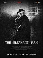 The Elephant Man